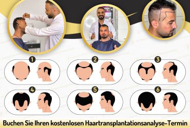 Haartransplantation Mannheim Sandhofen