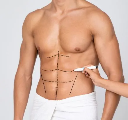 Six Pack Operation